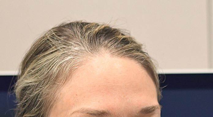 Here’s how to remove a liver tumor without a scalpel Dr. Lindsey Pierce