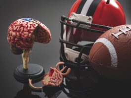 CTE illustration