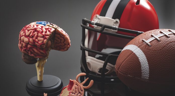 CTE illustration